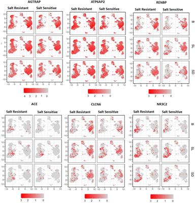 Regulation of human salt-sensitivite hypertension by myeloid cell renin-angiotensin-aldosterone system
